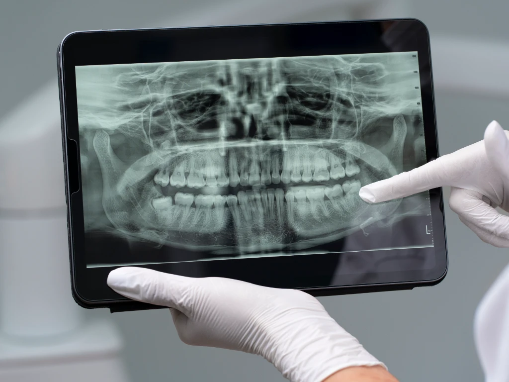Área de radiografías dentales en Cumbres